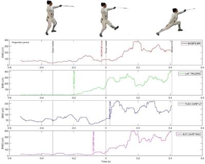 The phenomenon of anticipation in fencing. An applicability approach
